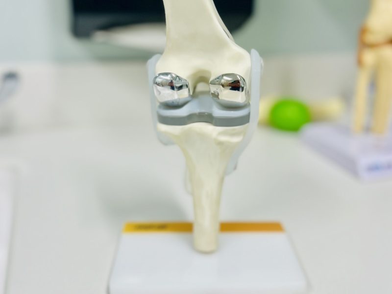 artificial-knee-joint-2026-01-06-09-47-15-utc